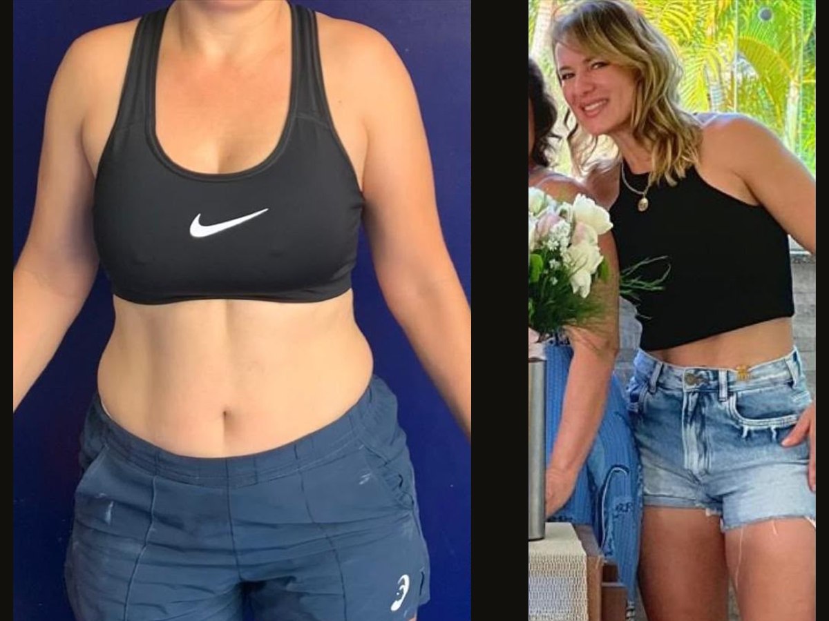 Aluna da SAUT Atibaia, antes e depois